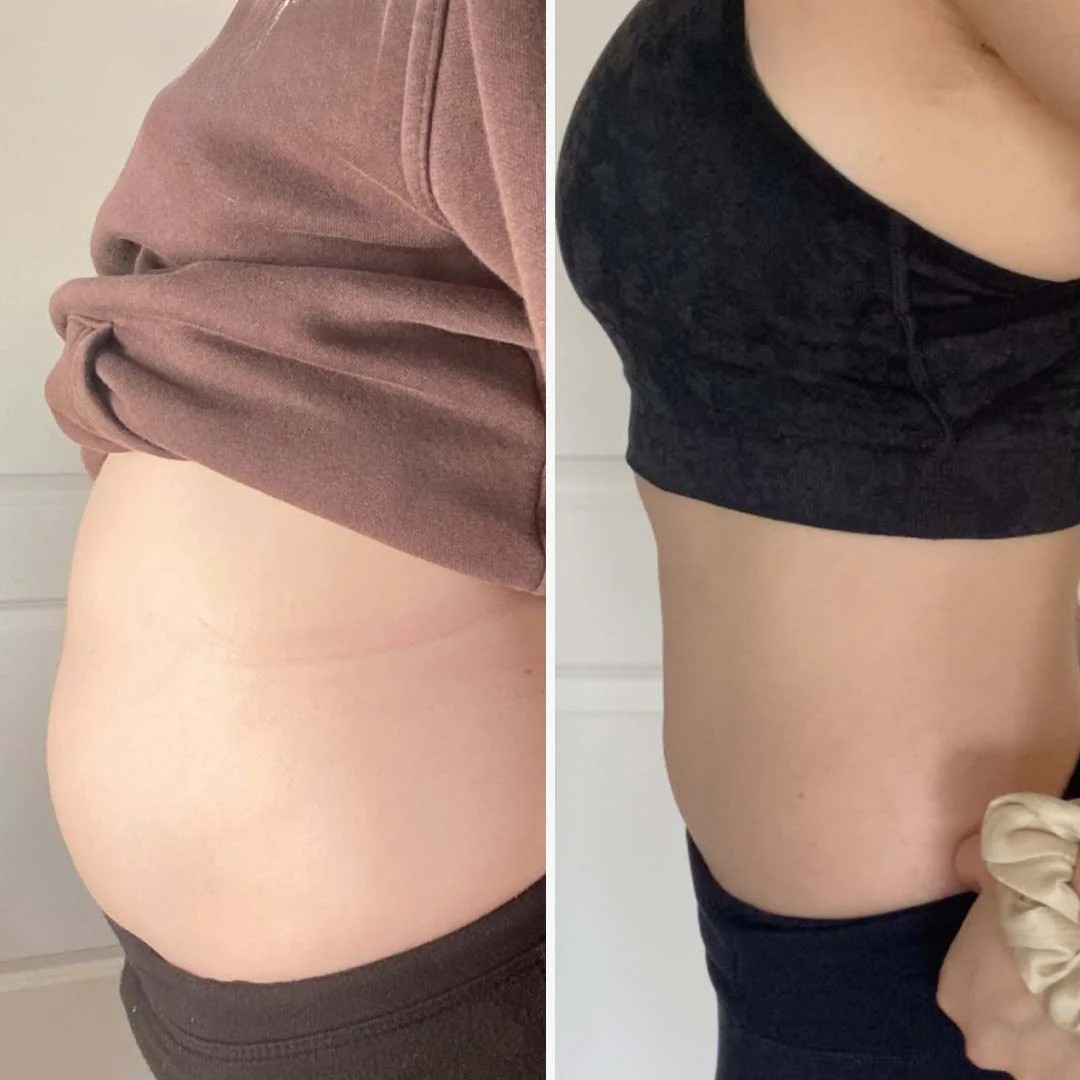 Renee T., 51 before and after herDOSE