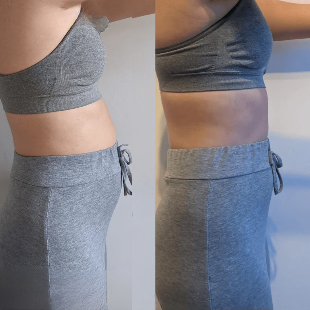 Marisol D., 56 before and after herDOSE